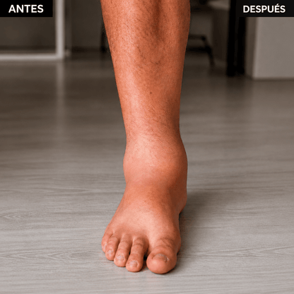 Soporte de tobillo para alivio del dolor y estabilidad.